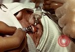 Image of eye surgery United States USA, 1945, second 51 stock footage video 65675077559