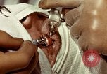 Image of eye surgery United States USA, 1945, second 52 stock footage video 65675077559
