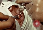 Image of eye surgery United States USA, 1945, second 53 stock footage video 65675077559