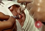 Image of eye surgery United States USA, 1945, second 55 stock footage video 65675077559