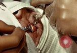 Image of eye surgery United States USA, 1945, second 57 stock footage video 65675077559