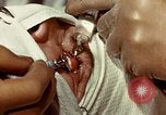 Image of eye surgery United States USA, 1945, second 58 stock footage video 65675077559