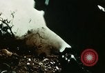 Image of eye surgery United States USA, 1945, second 8 stock footage video 65675077560