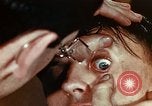 Image of eye surgery United States USA, 1945, second 23 stock footage video 65675077560
