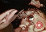 Image of eye surgery United States USA, 1945, second 24 stock footage video 65675077560