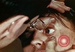 Image of eye surgery United States USA, 1945, second 26 stock footage video 65675077560