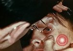 Image of eye surgery United States USA, 1945, second 27 stock footage video 65675077560