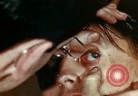 Image of eye surgery United States USA, 1945, second 28 stock footage video 65675077560