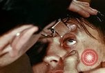 Image of eye surgery United States USA, 1945, second 29 stock footage video 65675077560