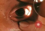Image of eye surgery United States USA, 1945, second 38 stock footage video 65675077560
