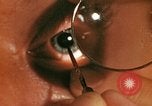 Image of eye surgery United States USA, 1945, second 41 stock footage video 65675077560