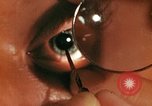 Image of eye surgery United States USA, 1945, second 43 stock footage video 65675077560