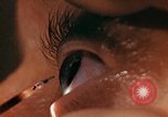 Image of eye surgery United States USA, 1945, second 44 stock footage video 65675077560