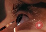 Image of eye surgery United States USA, 1945, second 45 stock footage video 65675077560