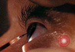 Image of eye surgery United States USA, 1945, second 46 stock footage video 65675077560