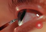 Image of eye surgery United States USA, 1945, second 52 stock footage video 65675077560