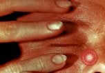 Image of eye surgery United States USA, 1945, second 57 stock footage video 65675077560