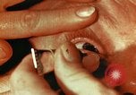 Image of eye surgery United States USA, 1945, second 58 stock footage video 65675077560
