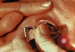 Image of eye surgery United States USA, 1945, second 59 stock footage video 65675077560