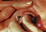 Image of eye surgery United States USA, 1945, second 60 stock footage video 65675077560