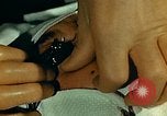 Image of ocular enucleation United States USA, 1945, second 8 stock footage video 65675077561