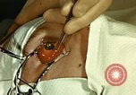 Image of ocular enucleation United States USA, 1945, second 26 stock footage video 65675077561