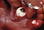 Image of ocular examination United States USA, 1945, second 8 stock footage video 65675077562