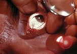 Image of ocular examination United States USA, 1945, second 9 stock footage video 65675077562