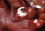 Image of ocular examination United States USA, 1945, second 10 stock footage video 65675077562