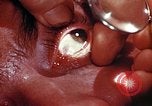 Image of ocular examination United States USA, 1945, second 11 stock footage video 65675077562