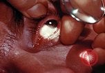 Image of ocular examination United States USA, 1945, second 12 stock footage video 65675077562