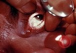 Image of ocular examination United States USA, 1945, second 13 stock footage video 65675077562