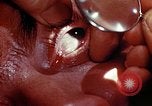 Image of ocular examination United States USA, 1945, second 14 stock footage video 65675077562