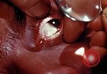 Image of ocular examination United States USA, 1945, second 15 stock footage video 65675077562