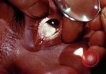 Image of ocular examination United States USA, 1945, second 16 stock footage video 65675077562