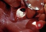 Image of ocular examination United States USA, 1945, second 17 stock footage video 65675077562