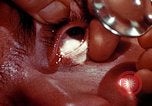 Image of ocular examination United States USA, 1945, second 18 stock footage video 65675077562