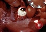 Image of ocular examination United States USA, 1945, second 19 stock footage video 65675077562