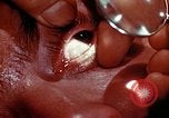 Image of ocular examination United States USA, 1945, second 20 stock footage video 65675077562