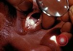 Image of ocular examination United States USA, 1945, second 21 stock footage video 65675077562