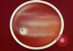 Image of ocular examination United States USA, 1945, second 45 stock footage video 65675077562