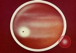 Image of ocular examination United States USA, 1945, second 46 stock footage video 65675077562