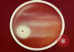 Image of ocular examination United States USA, 1945, second 47 stock footage video 65675077562