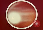 Image of ocular examination United States USA, 1945, second 48 stock footage video 65675077562