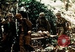 Image of ocular examination United States USA, 1945, second 55 stock footage video 65675077562