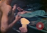 Image of wounded soldiers Saipan Northern Mariana Islands, 1944, second 8 stock footage video 65675077880