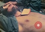 Image of wounded soldiers Saipan Northern Mariana Islands, 1944, second 36 stock footage video 65675077880