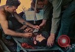Image of wounded soldiers Saipan Northern Mariana Islands, 1944, second 60 stock footage video 65675077880