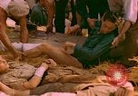 Image of wounded soldiers Marseilles France, 1944, second 28 stock footage video 65675078091