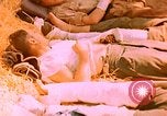Image of wounded soldiers Marseilles France, 1944, second 32 stock footage video 65675078091